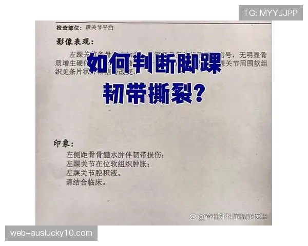 成都蓉城官方：韩国外援金敃友脚踝韧带损伤，预计休战八周